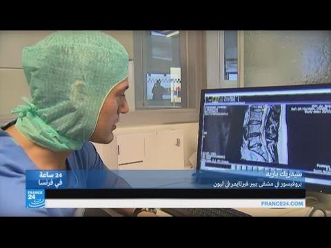 بالفيديو ثورة فرنسية في علاج الديسك