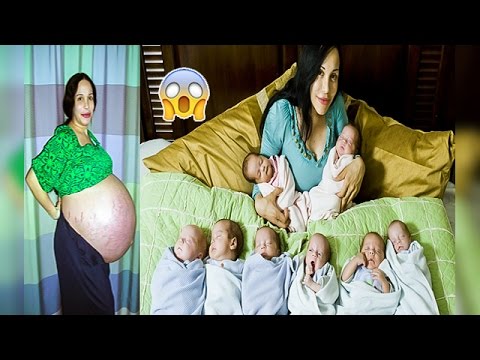 شاهد أغرب 5 حالات الولادة في العالم