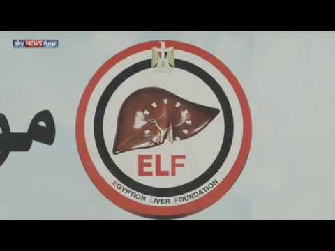 خطة مصرية للقضاء على التهاب الكبد الوبائي