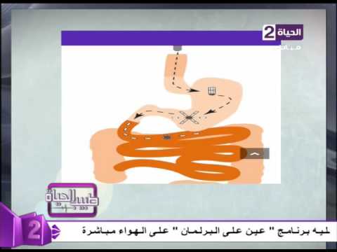 بالفيديو طفرة جديدة في مجال الطب لمرضى السكر والضغط