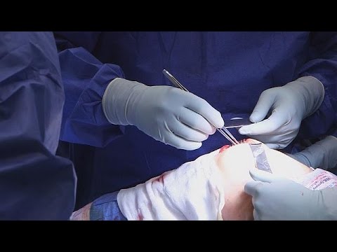 علاج المفاصل باستخدام خلايا جذعية من الأنف
