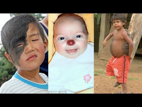 أغرب 6 عيوب خِلقية حول العالم