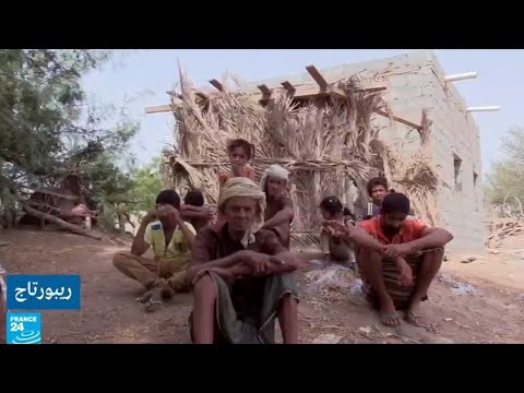 شاهد معاناة قرية المكفوفين اليمنية وسبب انتشار العمى فيها