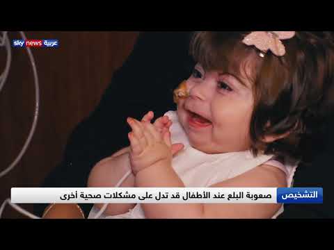 صعوبات البلع عند الأطفال وكيفية التعامل معها