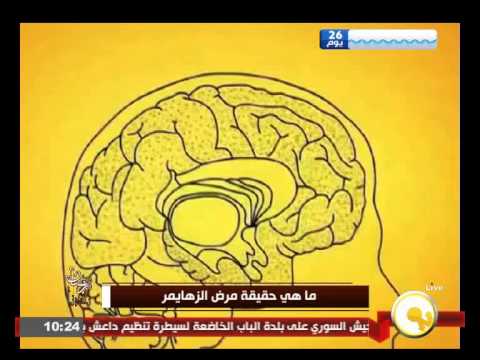 بالفيديو  ماهية مرض الزهايمر وأسبابه