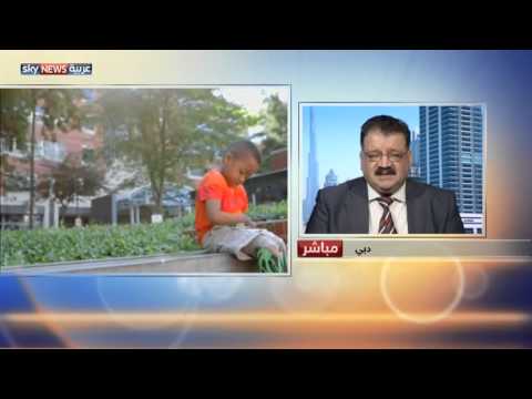 شاهد أول طفل يخضع لعملية زراعة يدين