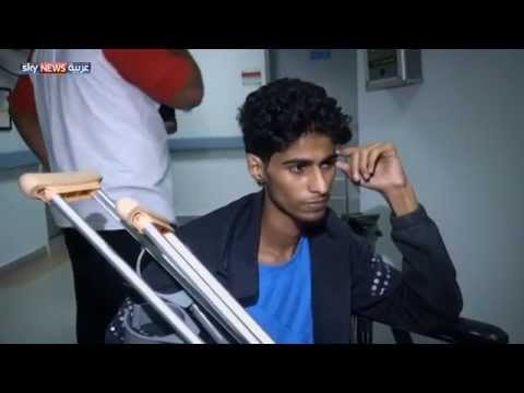 شاهد مصابون يمنيون يسافرون إلى الأردن لتلقي العلاج