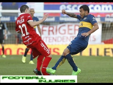 شاهد عمليات كسر الأقدام في الملاعب