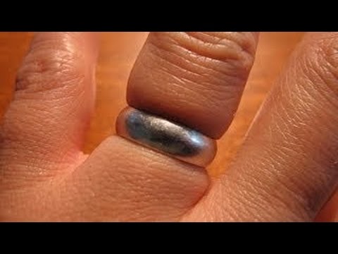 بالفيديو   طريقة لإخراج الخاتم العالق في الأصبع