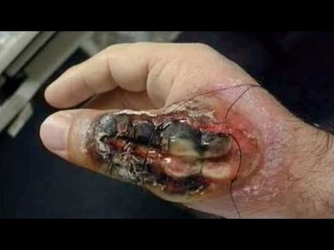 أخطر 10 حشرات في العالم لسعتها قد تؤدّي إلى الموت